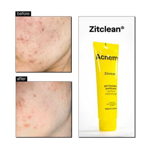 Очищувальний гель для проблемної шкіри Zitclean purifying cleansing gel
