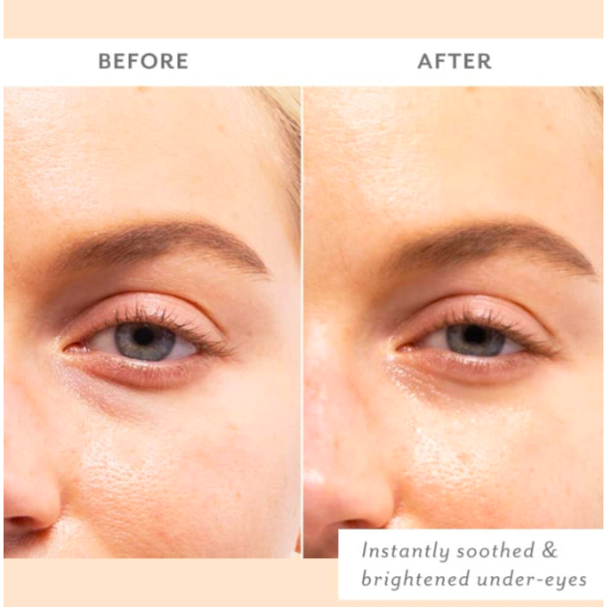 Заспокійливі патчі під очі Skin remedy soothing eye patches (1pcs)