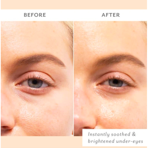 Заспокійливі патчі під очі Skin remedy soothing eye patches (1pcs)